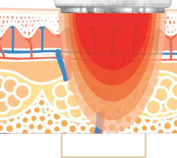 Noemí Azor Centre Mèdic-Estètic a La Garriga Noemí Azor Centre Mèdic-Estètic a La Garriga