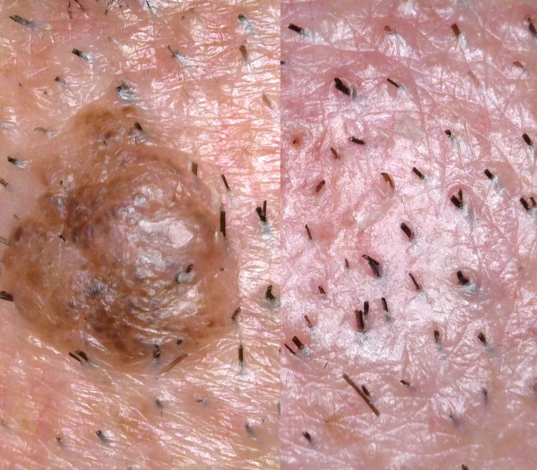 Noemí Azor Centre Mèdic-Estètic a La Garriga