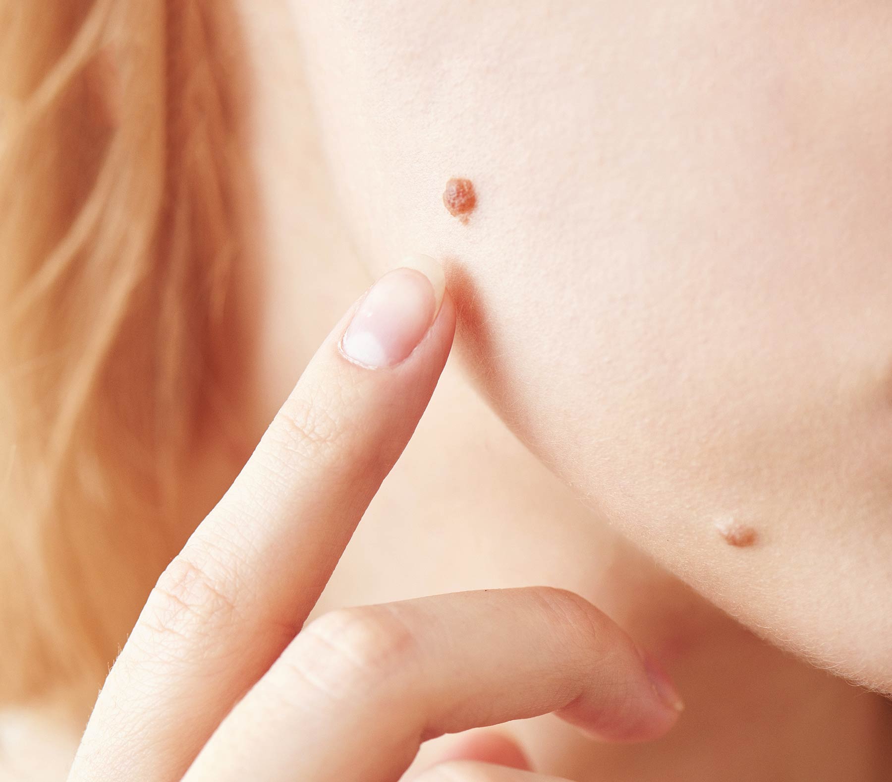 Noemí Azor Centre Mèdic-Estètic a La Garriga