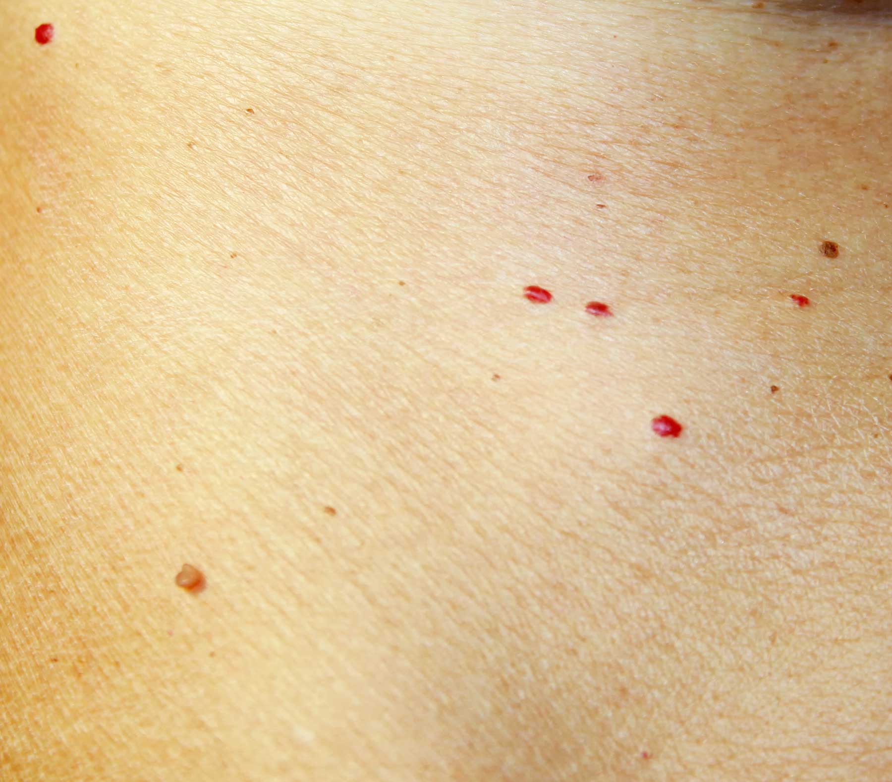 Noemí Azor Centre Mèdic-Estètic a La Garriga