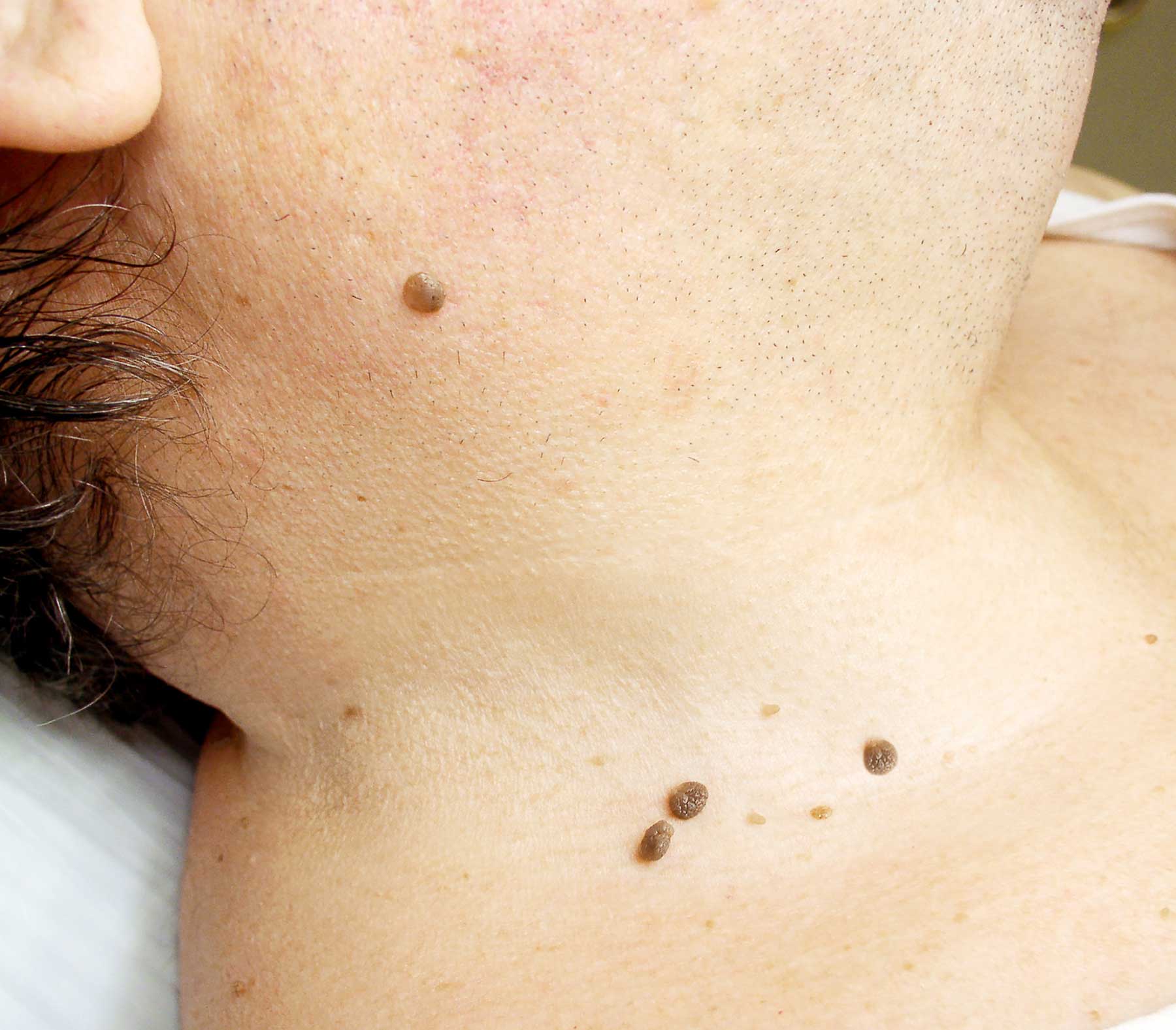 Noemí Azor Centre Mèdic-Estètic a La Garriga