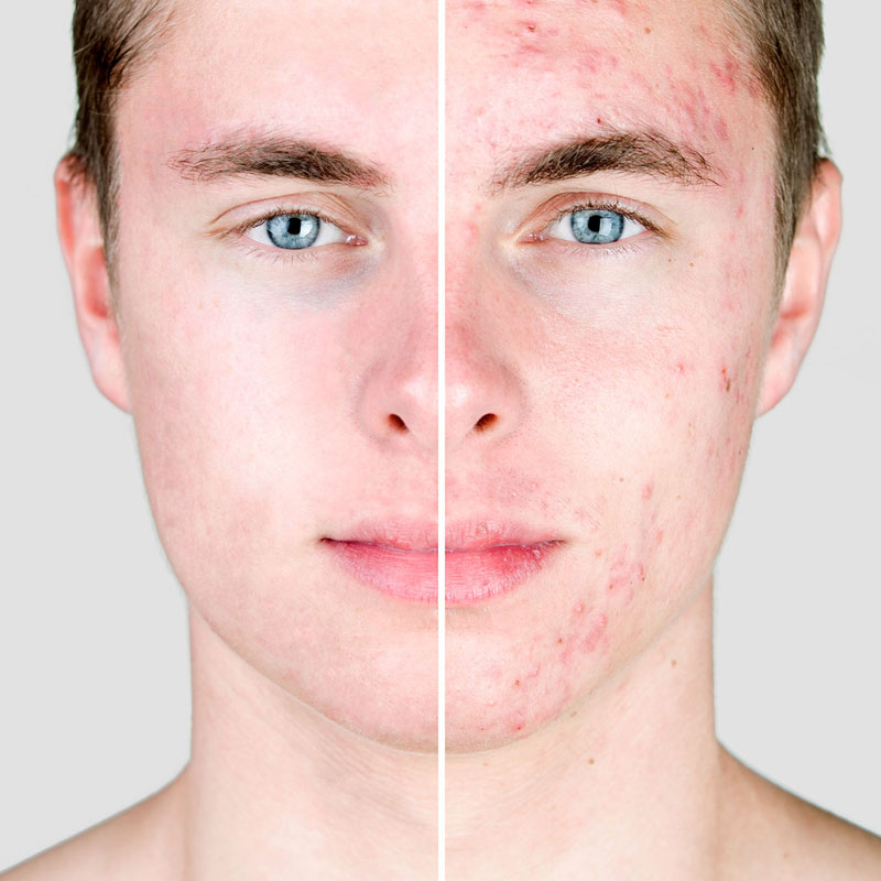 TRATAMIENTOS FACIALES Noemí Azor Centre Mèdic-Estètic a La Garriga