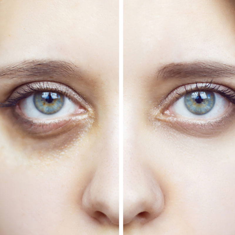 TRATAMIENTOS FACIALES Noemí Azor Centre Mèdic-Estètic a La Garriga