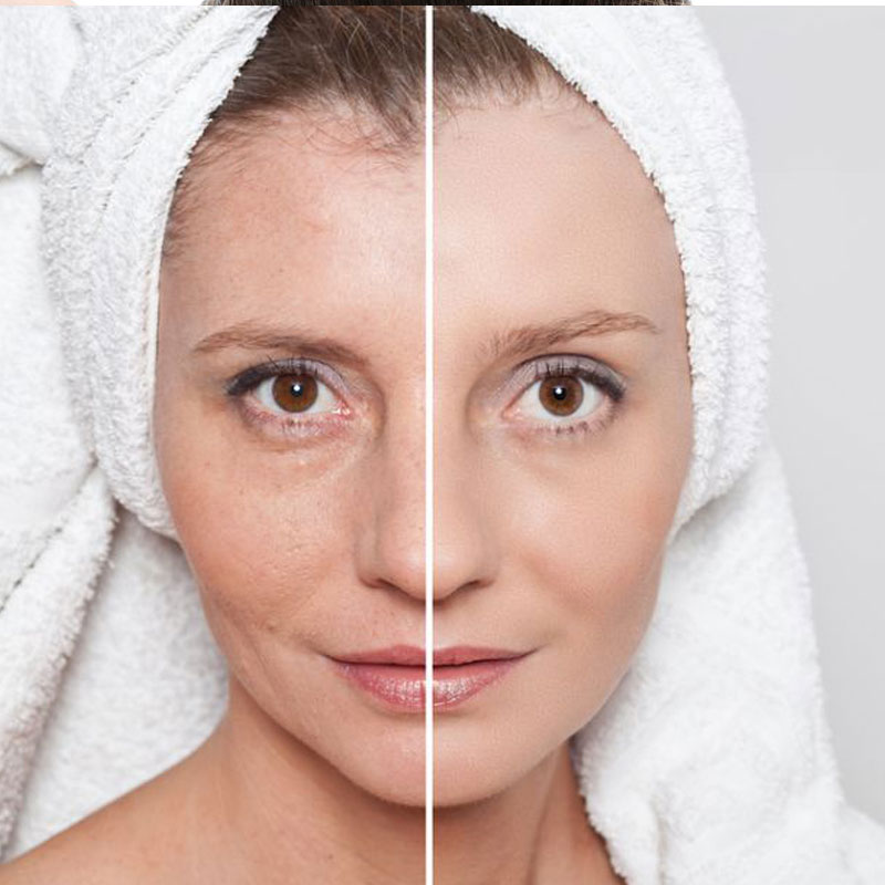 TRATAMIENTOS FACIALES Noemí Azor Centre Mèdic-Estètic a La Garriga