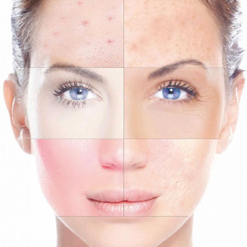 TRATAMIENTOS FACIALES Noemí Azor Centre Mèdic-Estètic a La Garriga