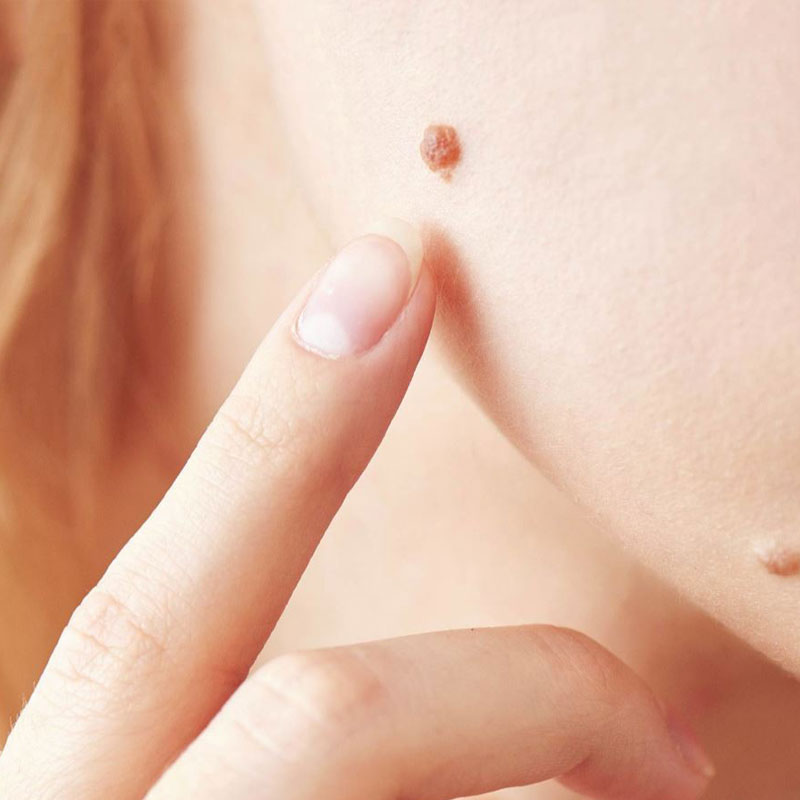 TRATAMIENTOS CORPORALES Noemí Azor Centre Mèdic-Estètic a La Garriga