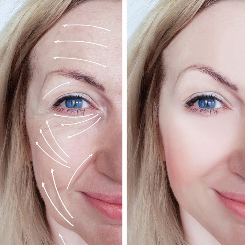 TRATAMIENTOS FACIALES Noemí Azor Centre Mèdic-Estètic a La Garriga