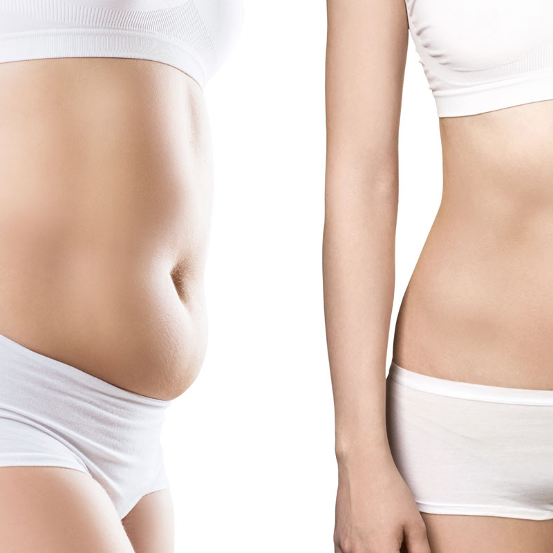 TRATAMIENTOS CORPORALES Noemí Azor Centre Mèdic-Estètic a La Garriga