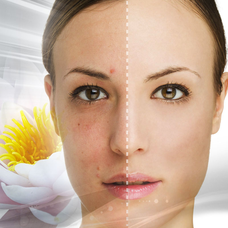 TRATAMIENTOS FACIALES Noemí Azor Centre Mèdic-Estètic a La Garriga