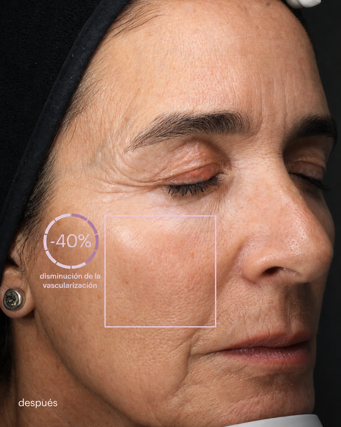 resultats de la gamma woman care solutions